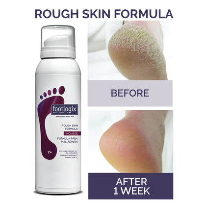 Footlogix Rough Skin Formula