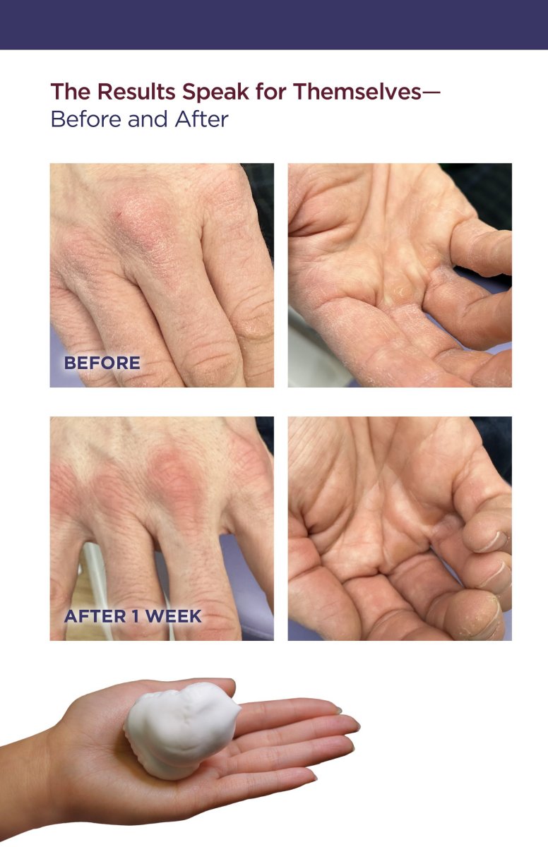 Hydrating Hand Mousse