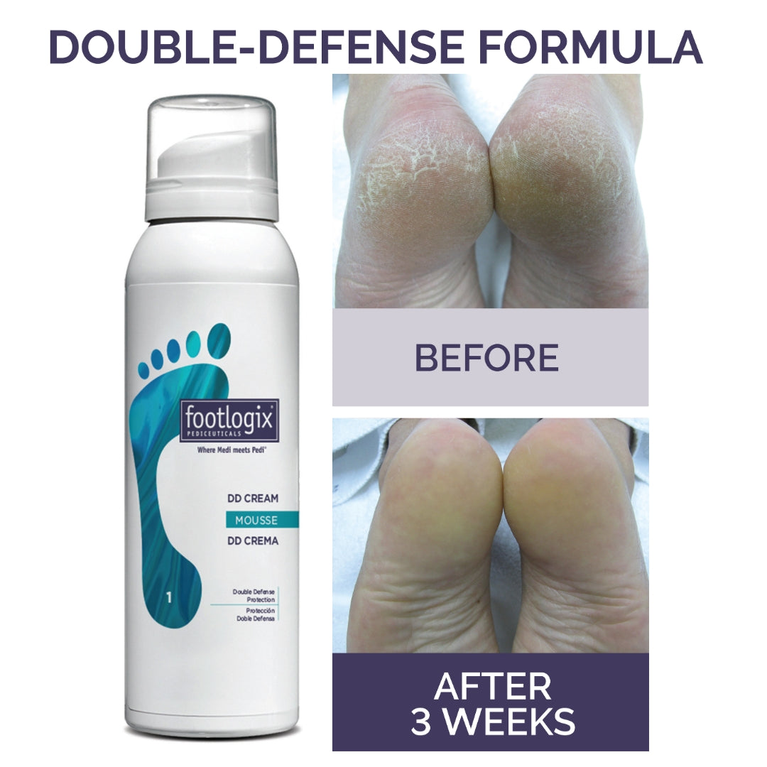 Footlogix DD Cream Mousse Formula