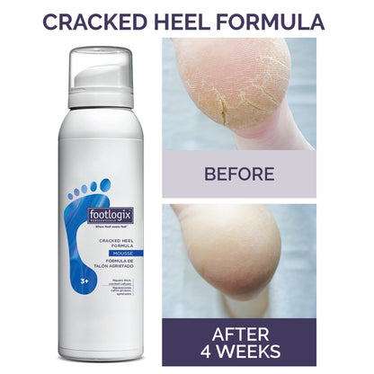 Footlogix Cracked Heel Formula